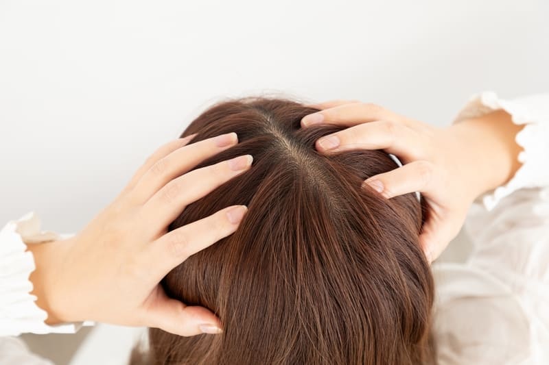 フケ対策シャンプーおすすめ人気15選【2025年】乾燥・脂性別の対策アイテムを紹介